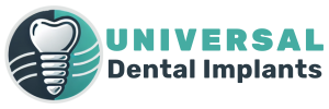 Universal Dental Implants